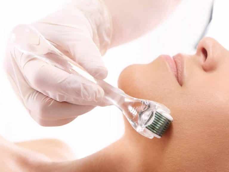 Mesoderm microneedling procedure